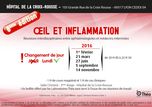 Oeil_et_inflammation